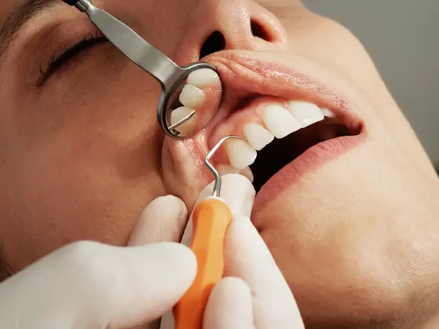 dental hygienist uses tools to thoroughly clean the mouth